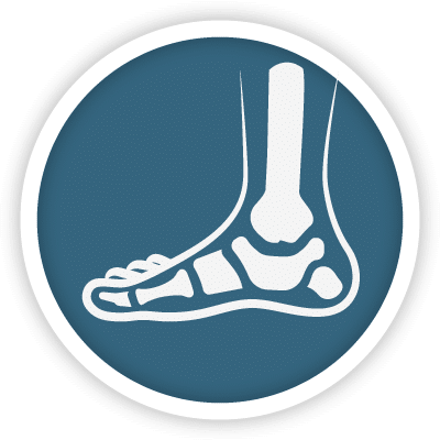 Treatment Options for Foot & Ankle Arthritis - The Orthopaedic Foot & Ankle  Center